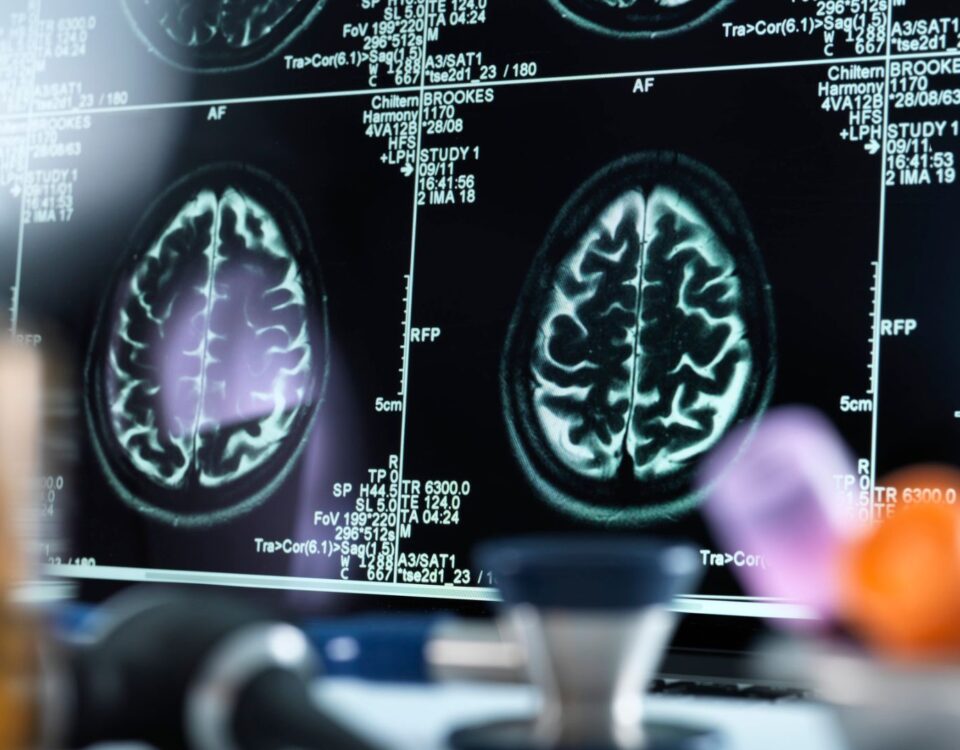 Neurologia Clinica